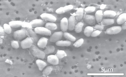 Halomonadaceae, GFAJ-1 Strain