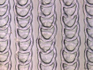 Vertically overlapping scale structure